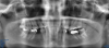 Fig 10. Preoperative panoramic radiograph.